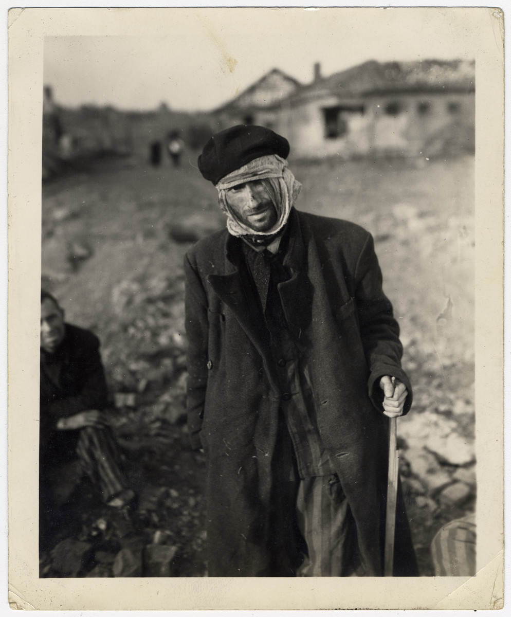 Close-up portrait of an emaciated survivor of the Nordhausen concentration camp.