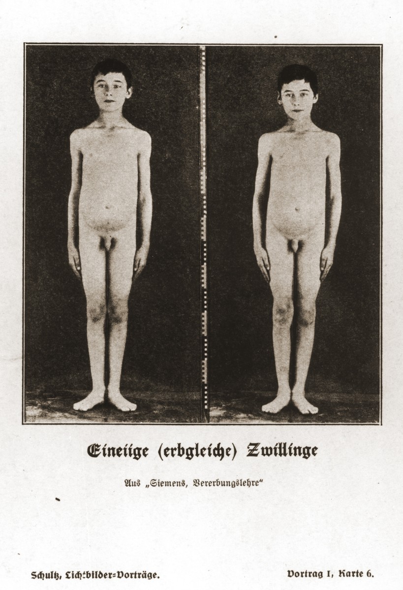 Photographs of a pair of genetically identical twins, taken from a set of slides produced to illustrate a lecture by Dr. Ludwig Arnold Schloesser, director of education for the SS Race and Settlement Office, on the foundations of the study of heredity. [Lecture 1, Card 6]