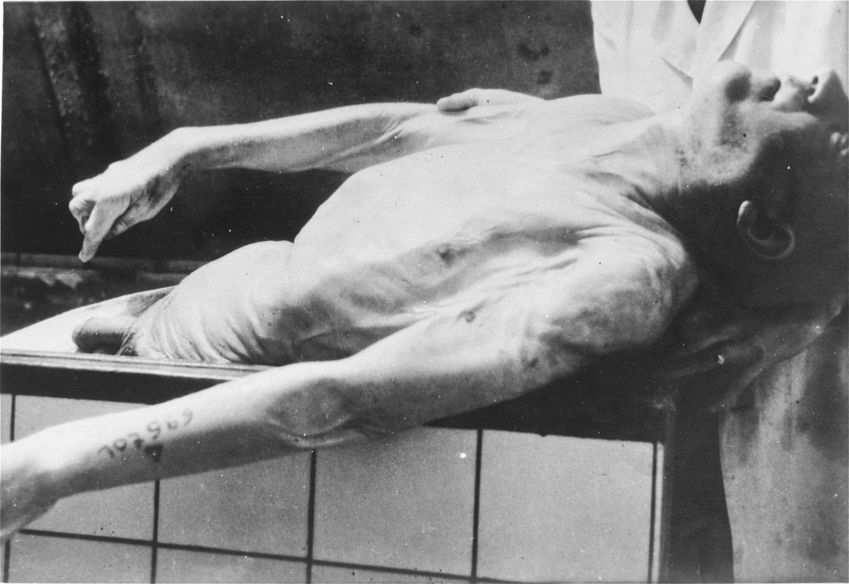 The corpse of a Jewish prisoner who was gassed at Natzweiler-Struthof and whose body was kept in a vat of alcohol at the Strasbourg University Anatomical Institute for over a year until it was discovered by Allied forces.

The prisoner has been identified as Max Menachem Taffel.

At the end of August,1943, eighty-six Jews, including 30 women, were gassed in Natzweiler-Struthof for the purpose of constructing a collection of skulls and skeletons to be kept at the Strasbourg University Institute of Anatomy, under the directorship of August Hirt.  The individuals were "selected" at Auschwitz for their special bone structure and transferred to Natzweiler, where SS Captain Josef Kramer, the commandant of the camp, oversaw the operation.  The corpses then remained in vats of alcohol for over a year, the project envisioned by Hirt having never been completed.  When Allied forces approached Strasbourg in November 1944, SS administrators were unaware that evidence of the crime still existed at the Institute, and only at the last minute ordered the bodies destroyed.  This operation failed, however, and 16-17 of the bodies fell into Allied hands. [Klarsfeld, S., ed. The Struthof Album, 1985]