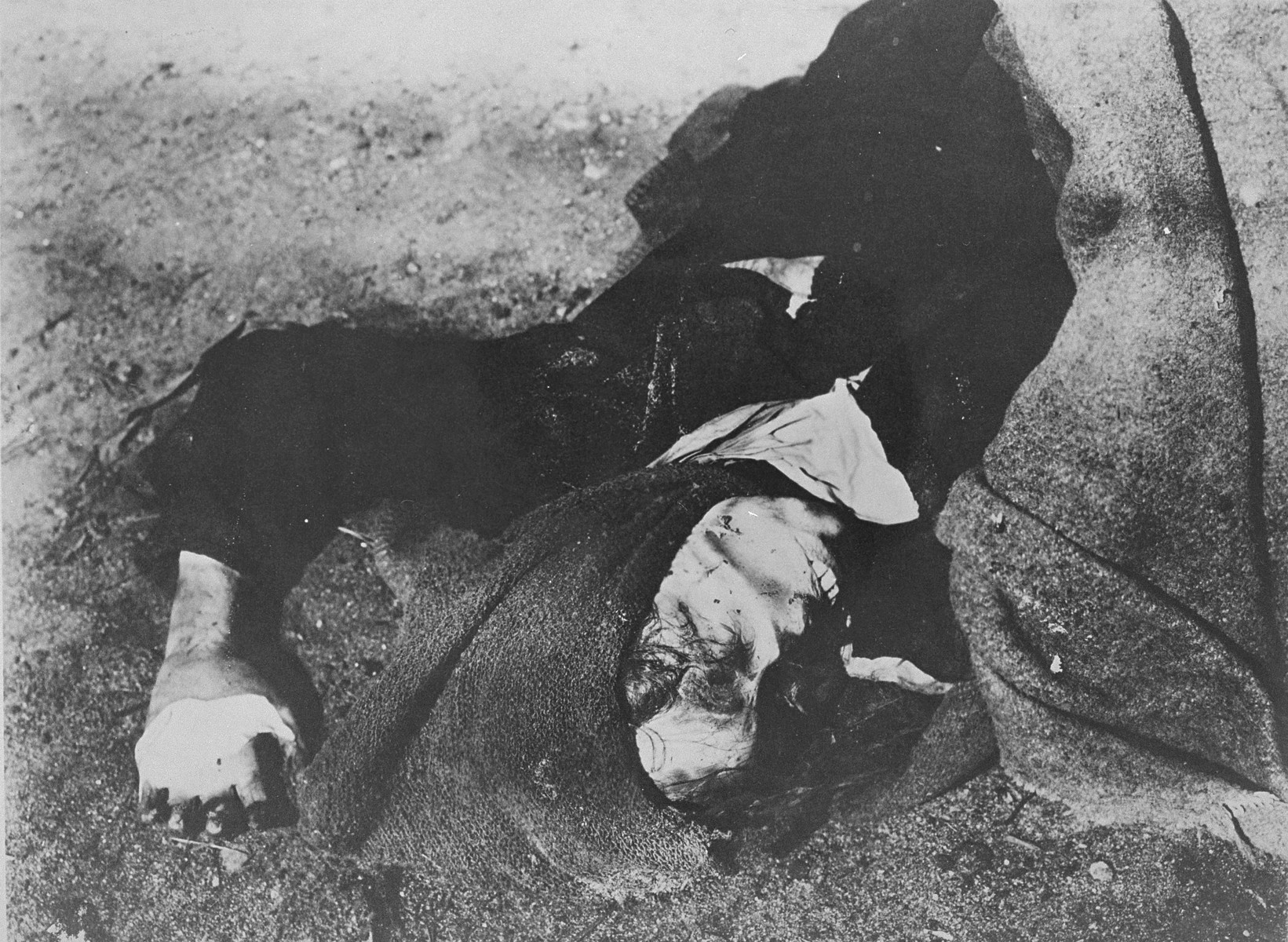 A decomposing corpse in Bergen-Belsen.