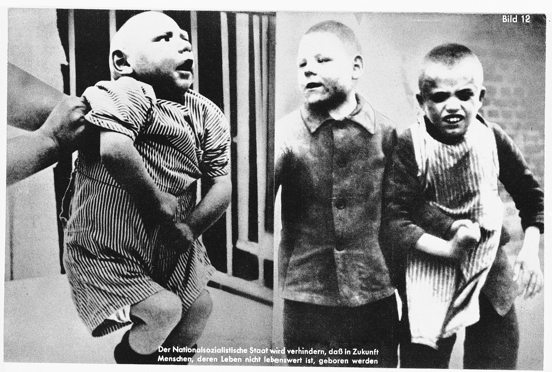 Nazi propaganda composite photograph showing mentally disabled children.

The original caption reads: "The National Socialist State in the future will prevent people whose lives are not worth living from being born."