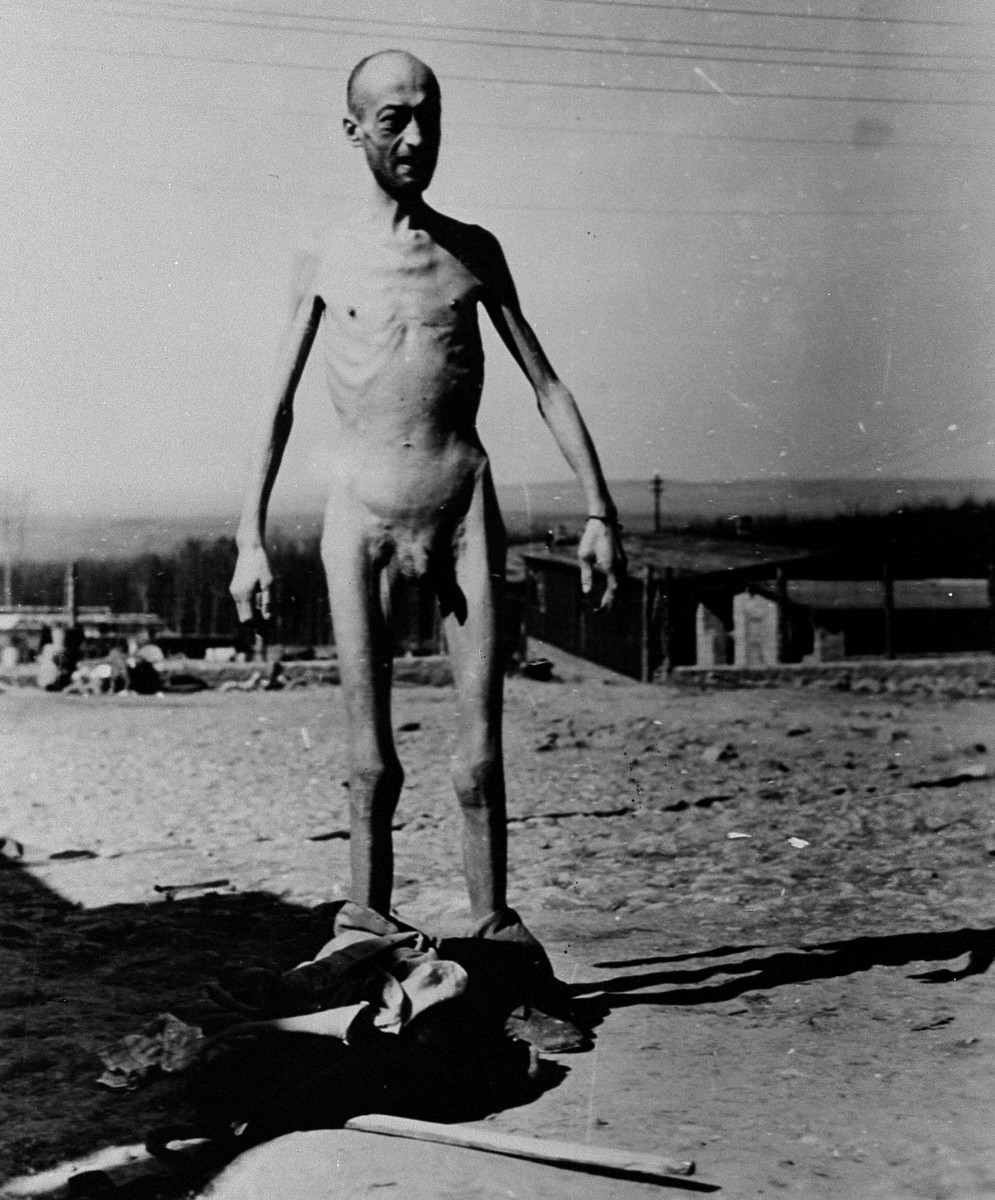 An emaciated survivor stands outside naked in the newly liberated Buchenwald concentration camp.