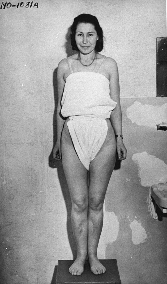 A war crimes investigation photo of Wladislava Karolewska, a survivor from Ravensbrueck, who was subjected to medical experiments with sulphonamide drugs in 1942. 

The experiments were conducted by Dr. Fritz Fischer, Prof. Karl Gebhardt, Dr. Stumpfegger and Ravensbrueck camp doctor, Herta Oberheuser.  This photograph was entered as evidence for the prosecution at the Medical Trial in Nuremberg.

The disfiguring scars on the woman's right leg resulted from incisions made by medical personnel that were purposely infected with bacteria, dirt and slivers of glass, in order to simulate the combat wounds of German soldiers fighting in the war.  The inflamed area was then treated with sulphonamide drugs.  Many of the prisoners subjected to these treatments died from their wounds.