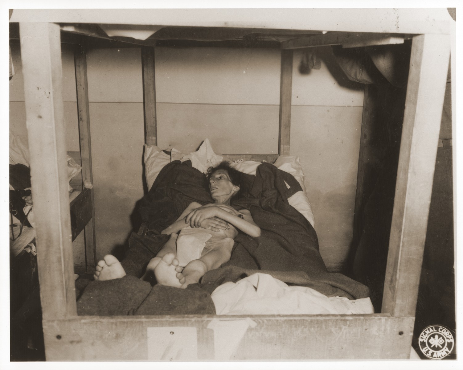 An emaciated female Jewish survivor of a death march lies in an American military field hospital in Volary, Czechoslovakia.

Pictured is Fela Szeps, who died the day after this photo was taken.