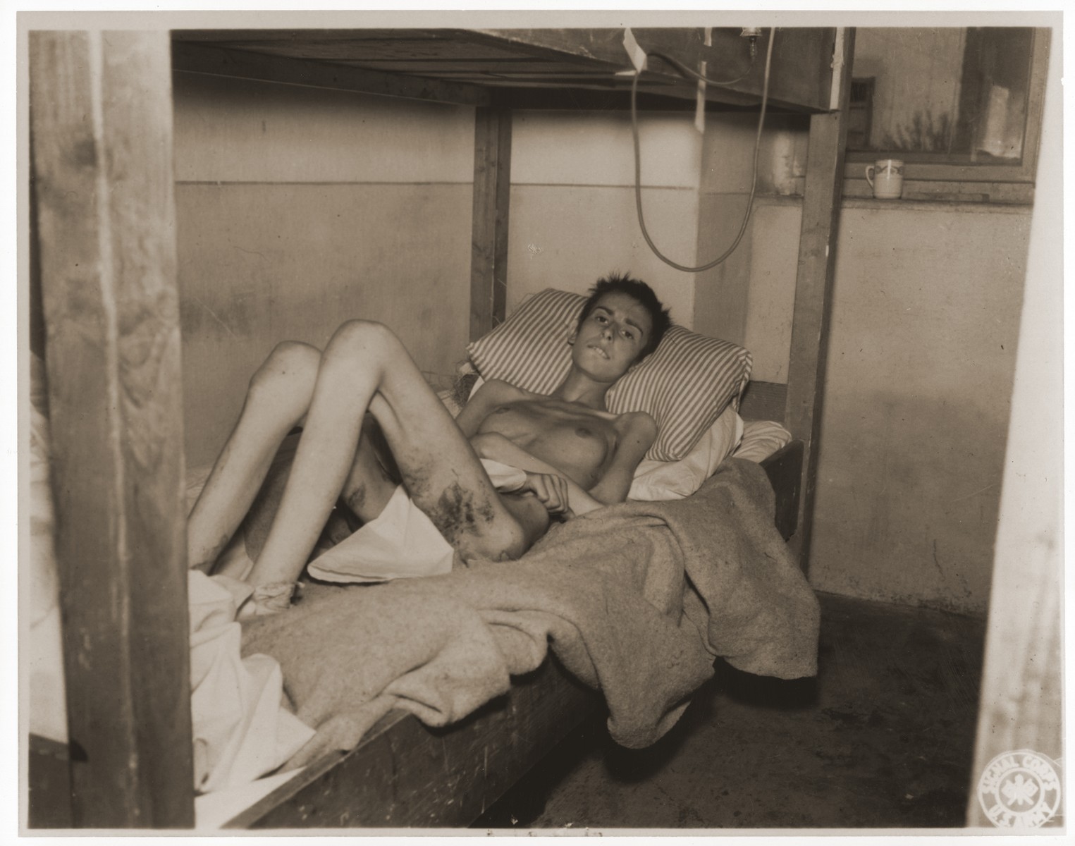 An emaciated female Jewish survivor of a death march lies in bed at an American military field hospital in Volary, Czechoslovakia.

Pictured is eighteen-year-old Liesl Steppe.