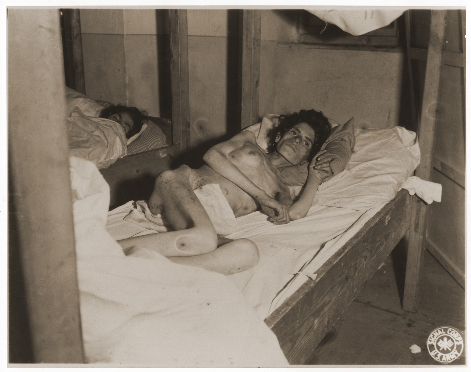 An emaciated female Jewish survivor of a death march lies in an American military field hospital in Volary, Czechoslovakia.

Pictured is twenty-two year old Bina Hauptman.