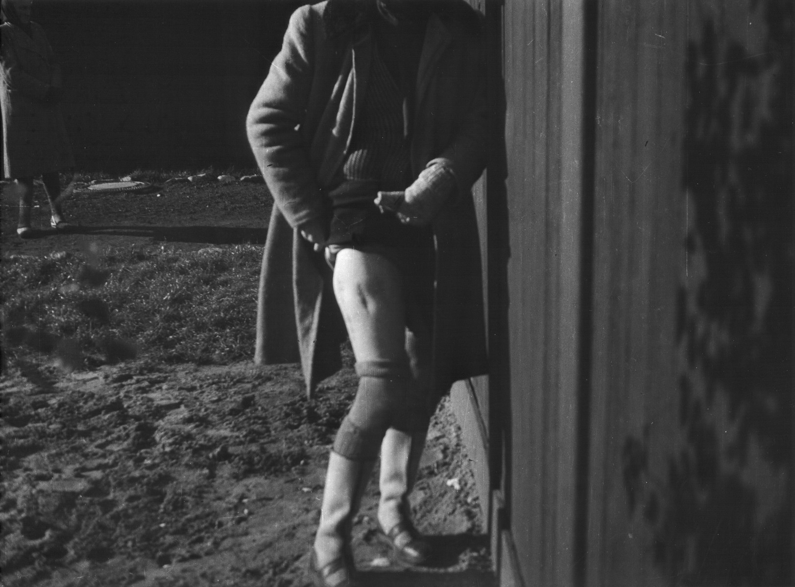 Clandestine photograph of the disfigured leg of Polish political prisoner, Bogumila Babinska (Jasiuk), in the Ravensbrueck concentration camp.