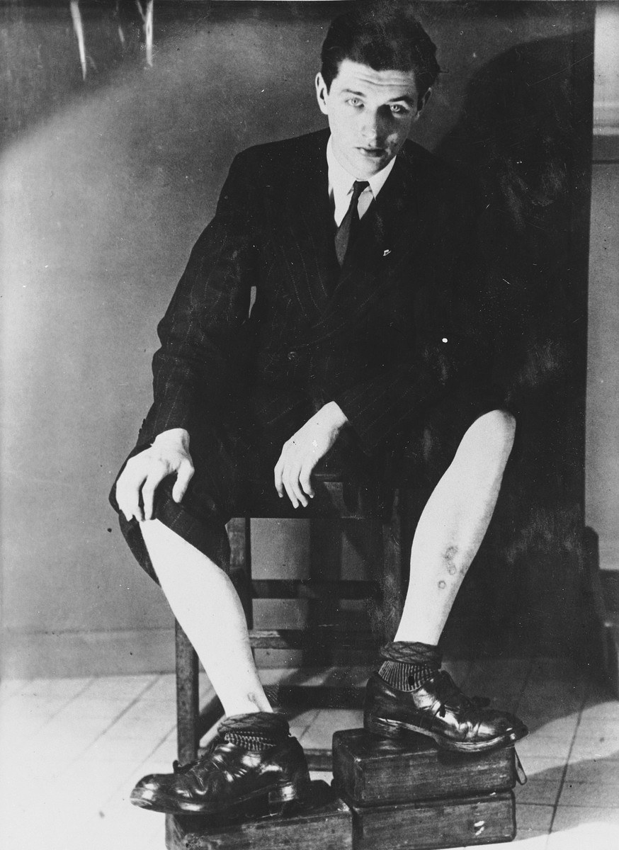 Paul de Rudder shows the scars on his legs as a result of his torture in the Breendonck internment camp.