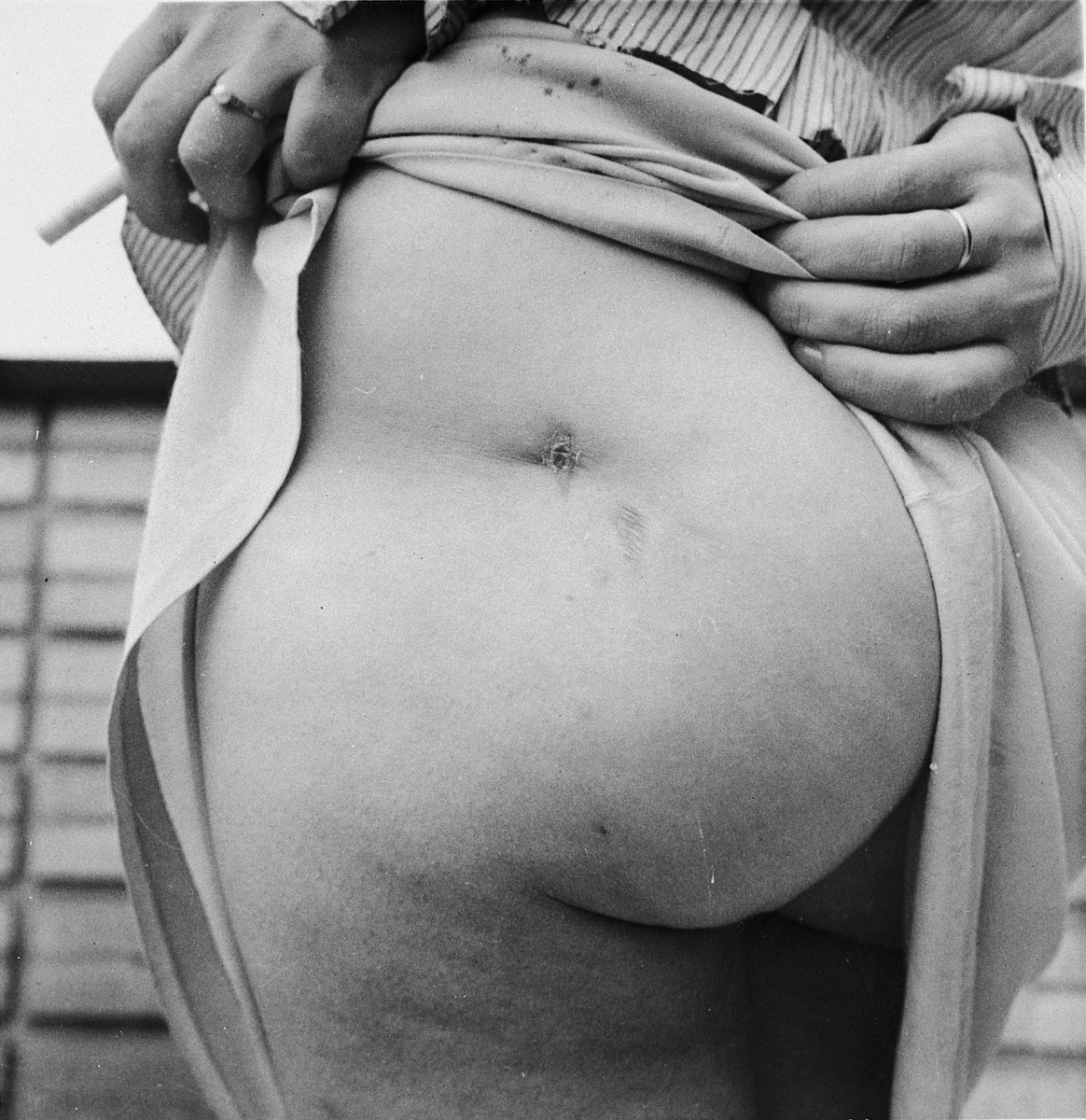 Madame Pacquet displays scars that she received as the result of torture in the Breendonck internment camp.