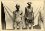 Close-up photograph of two naked, starving prisoners in the Dachau concentration camp.