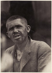 A survivor at the Bergen-Belsen concentration camp.