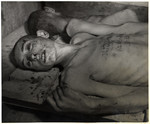Close-up portrait of a bloodied, emaciated man in an unidentified concentration camp with his name and number written on his chest.