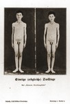 Photographs of a pair of genetically identical twins, taken from a set of slides produced to illustrate a lecture by Dr.