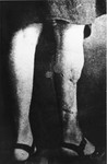 A war crimes investigation photo of the disfigured leg of Maria Kusmierczuk, a Ravensbrueck inmate, who was subjected to medical experiments with sulphonamide drugs in 1942.