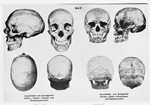 Racial portraits of different skulls.