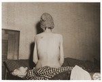 An emaciated female Jewish survivor of a death march sits up in bed at an American military field hospital in Volary, Czechoslovakia.