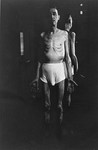 An emaciated survivor who was imprisoned for five weeks in the Breendonck concentration camp.