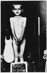 Portrait of a naked child who was liberated from a Croatian concentration camp standing behind a slate with his name.