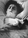 A Jewish woman who was injured during the Kielce pogrom lies in a hospital bed.