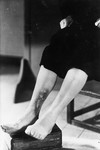 A survivor shows the scars on her legs as a result of her torture in the Breendonck internment camp.
