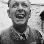 Mr. Emile Scieur displays his missing teeth as a result of torture received during his seventeen month imprisonment in the Breendonck internment camp.