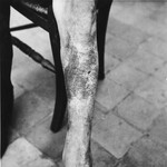 Emile Scieur shows the scarring on his leg that resulted from being beaten with a rubber truncheon in the Breendonck internment camp.